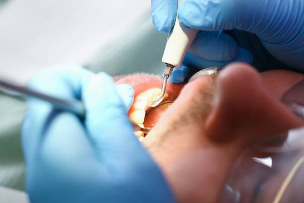 Best After-Hours Emergency Dentist in Webberville, MI