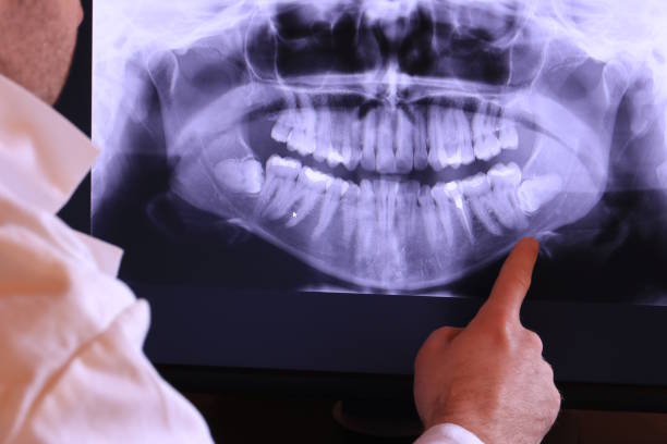 Best Emergency Treatment for Toothache in Webberville, MI