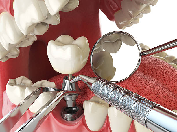 Best Weekend Emergency Dentist in Webberville, MI